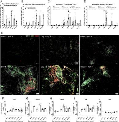 Podoplanin expressing macrophages and their involvement in tertiary lymphoid structures in mouse models of Sjögren’s disease